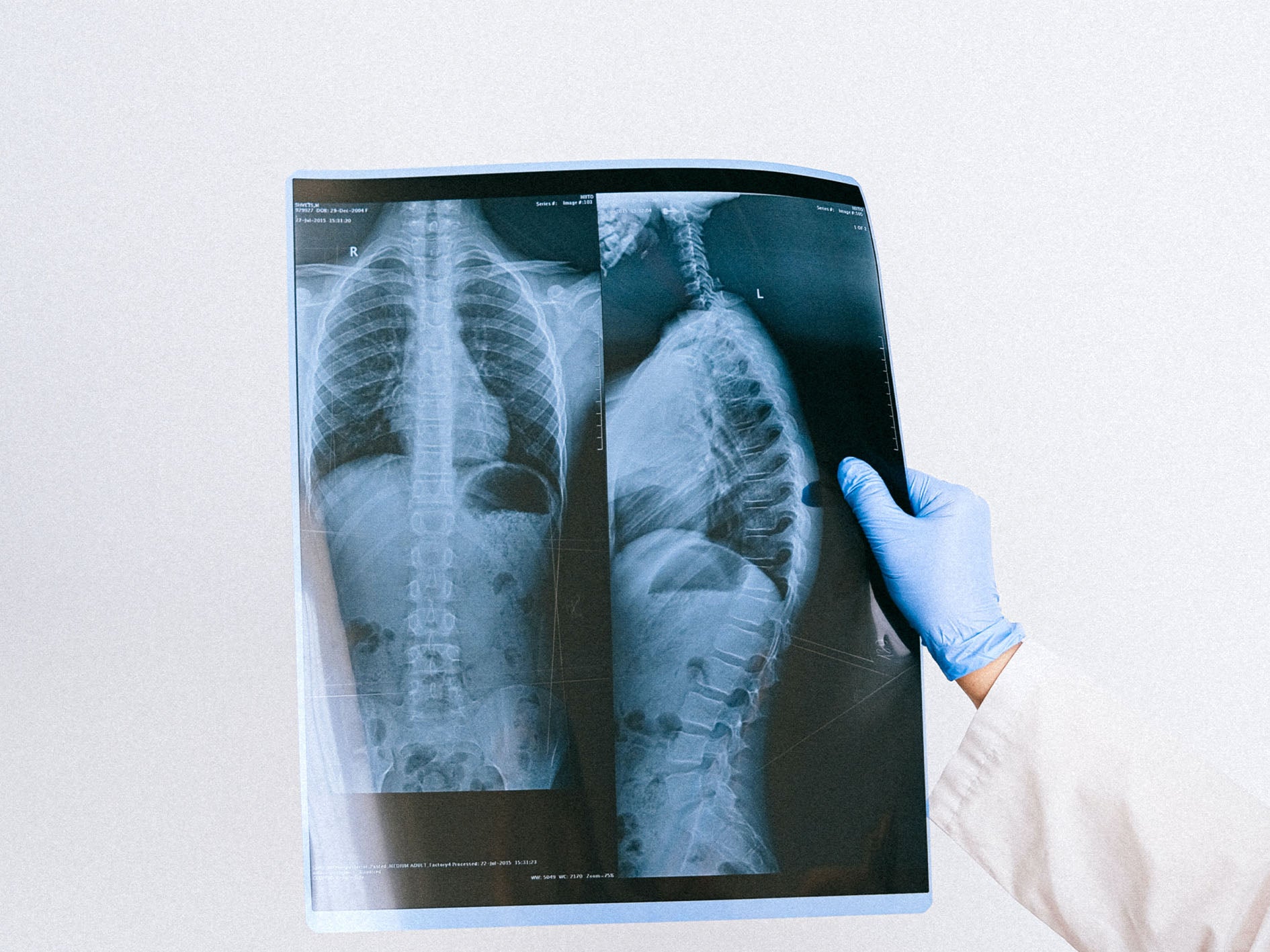 5 façons de garder vos poumons en bonne santé