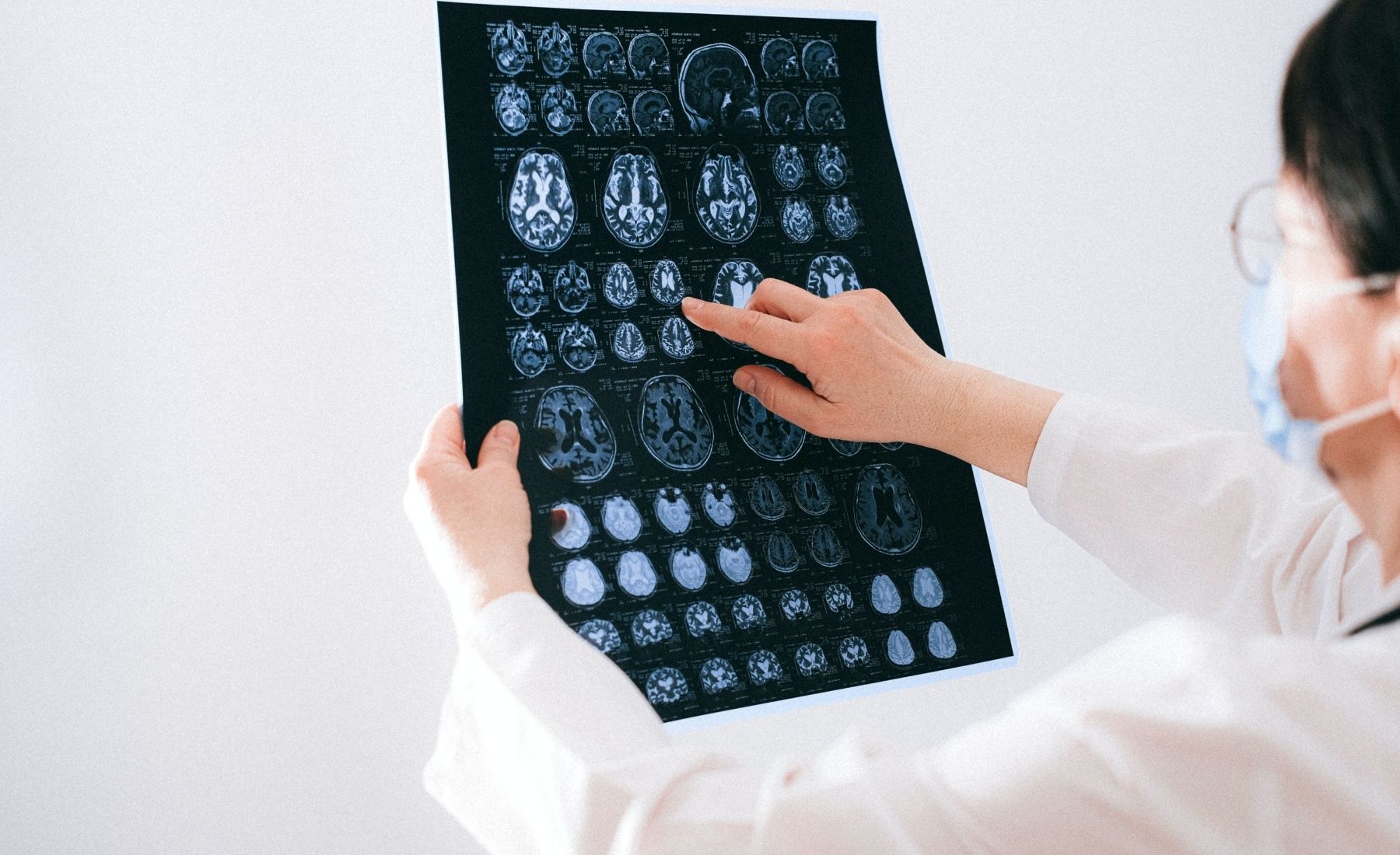 Tout ce que vous vasculaires cérébraux devez savoir sur les accidents